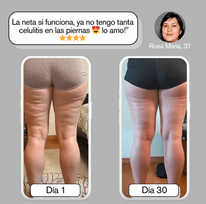 Belle Silouette™ Masajeador Anticelulítico