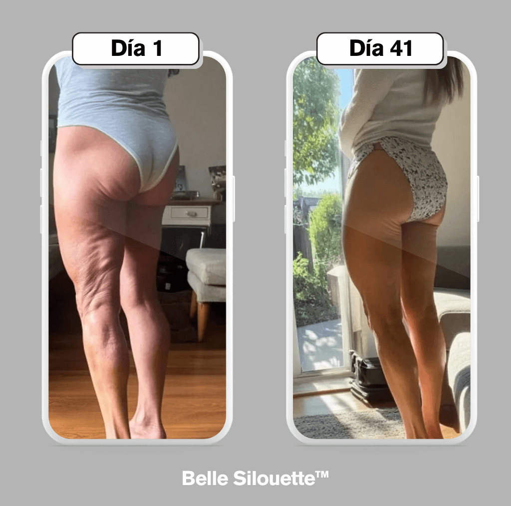 Belle Silouette™ Masajeador Anticelulítico