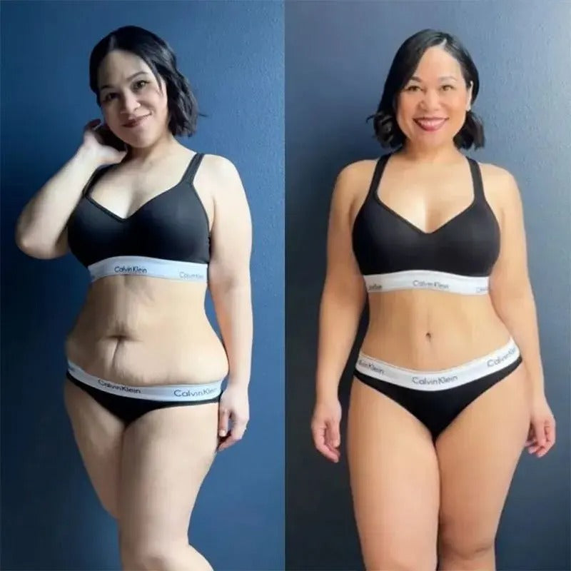 Belle Silouette™ Masajeador Anticelulítico