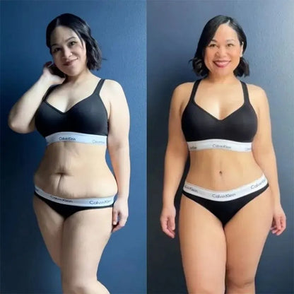 Belle Silouette™ Masajeador Anticelulítico