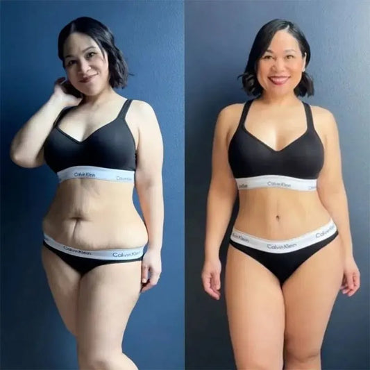 Belle Silouette™ Masajeador Anticelulítico